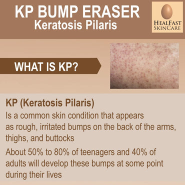 Healfast KP Bump Eraser Cream (4 Oz) and Bodywash (8 Oz) Set – Soften, Exfoliate, Nourish Rough and Bumpy Skin – Keratosis Pilaris - For All Types