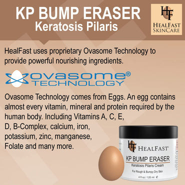 HealFast KP Bump Eraser Cream 4 Oz – Soften, Nourish Rough and Bumpy Skin with 2% BHA – Keratosis Pilaris - For All Types – No Scrubbing Required – Fragrance and Paraben Free