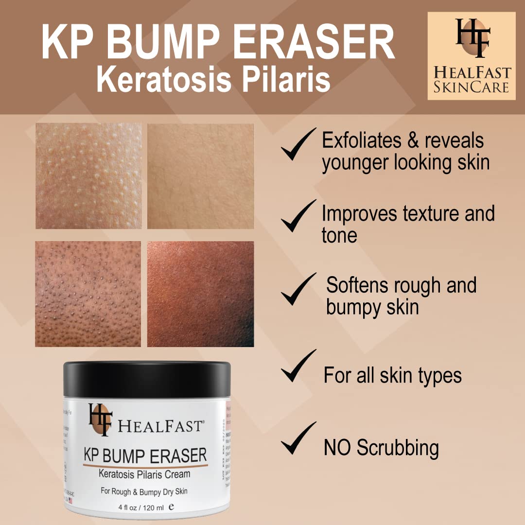 Healfast KP Bump Eraser Cream (4 Oz) and Bodywash (8 Oz) Set – Soften, Exfoliate, Nourish Rough and Bumpy Skin – Keratosis Pilaris - For All Types