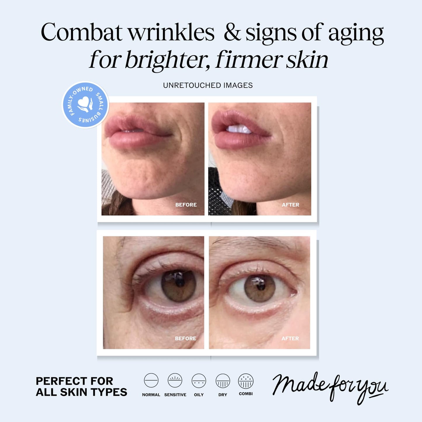 LilyAna Naturals Anti Aging Retinol Face Cream for Women – Wrinkle & Neck Cream for Firming, Retinol Moisturizer for Face with Hyaluronic Acid, Hydrating Night Cream for Fine Lines, Collagen Boost