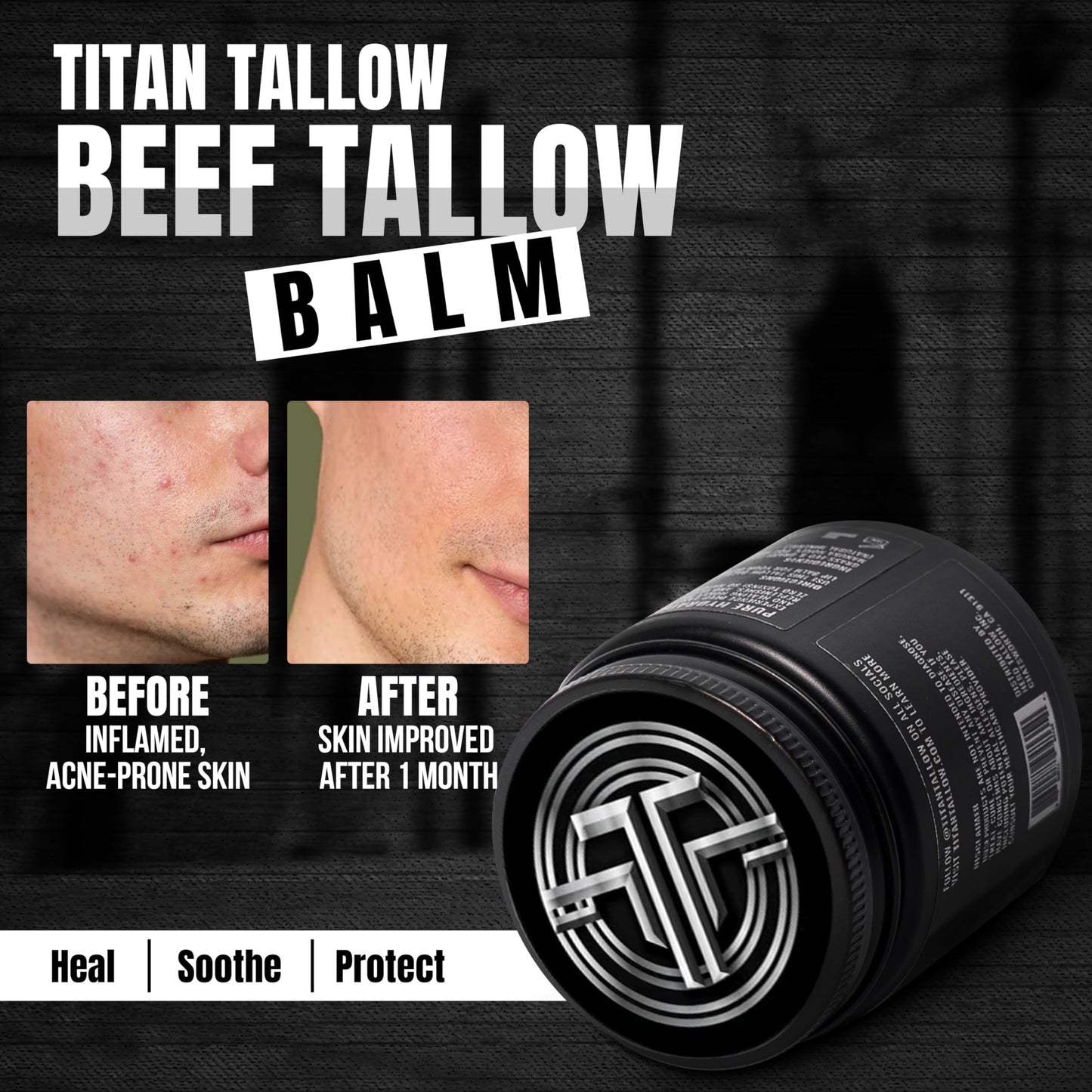 Magnesium Beef Tallow Balm for Sleep, Leg Cramps & Pain, Muscle Relaxation, Moisturizing Topical Cream - Organic Grass-Fed & Grass-Finished Tallow with Manuka Honey Skin Care, Face & Body Lotion