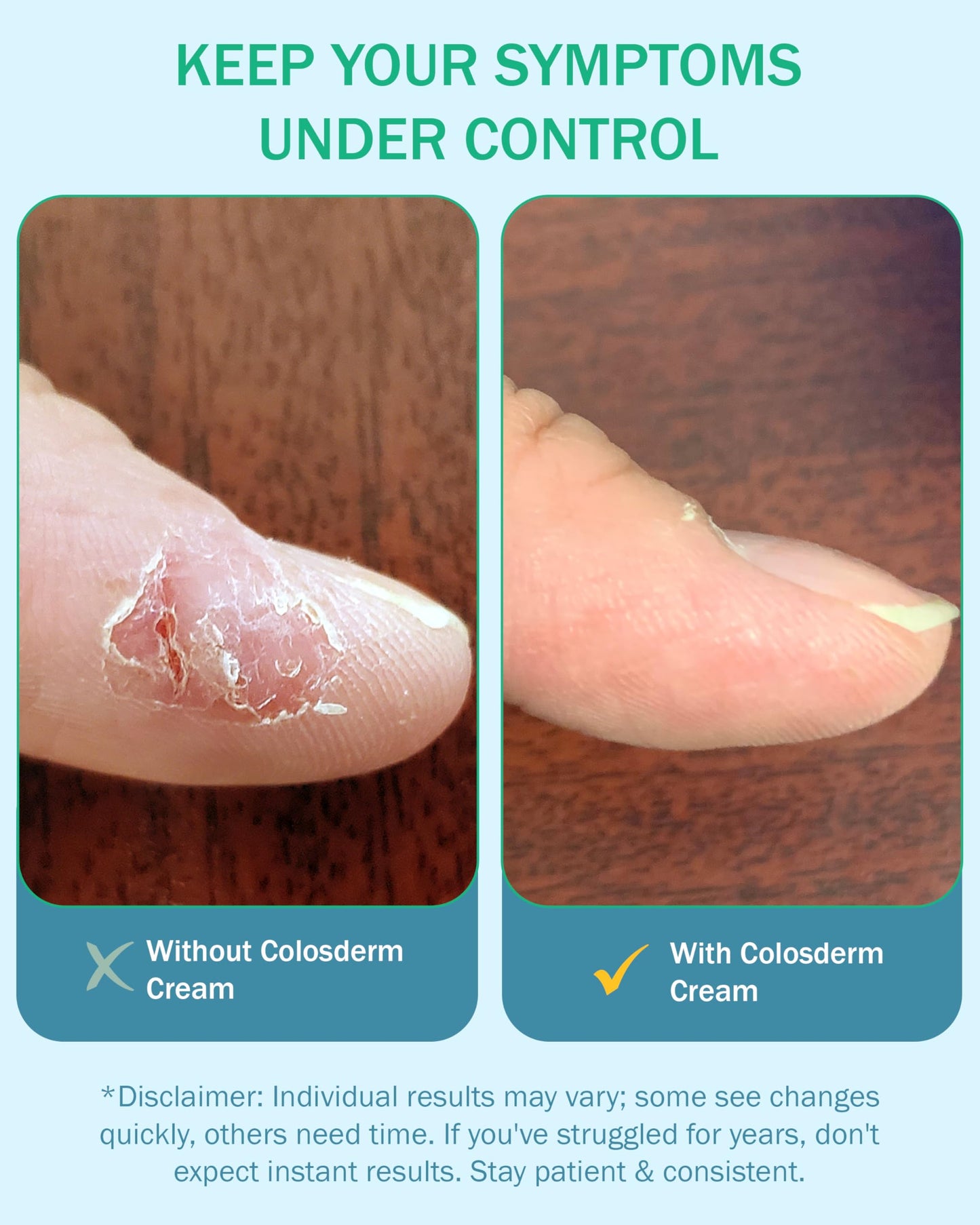 Eczema Cream for Kids & Adults, Daily Moisturizing Body Lotion for Sensitive Skin, Soothing Eczema Treatment Relief, Colloidal Oatmeal & Colostrum for Dry & Itchy Skin, Steroid- & Fragrance-Free, 4 oz