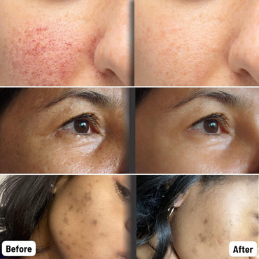 ORGAID Organic Sheet Mask | Made in USA (Anti-aging & Moisturizing)