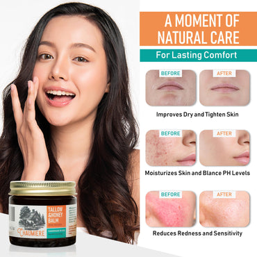 Chaumiere Herb Infused Organic Grass Fed Beef Tallow Honey Balm -Tallow Face Moisturizer - Whipped Tallow and Honey Balm - Raw Honey, Facial Lotion for Sensitive Skin - 2.5 oz