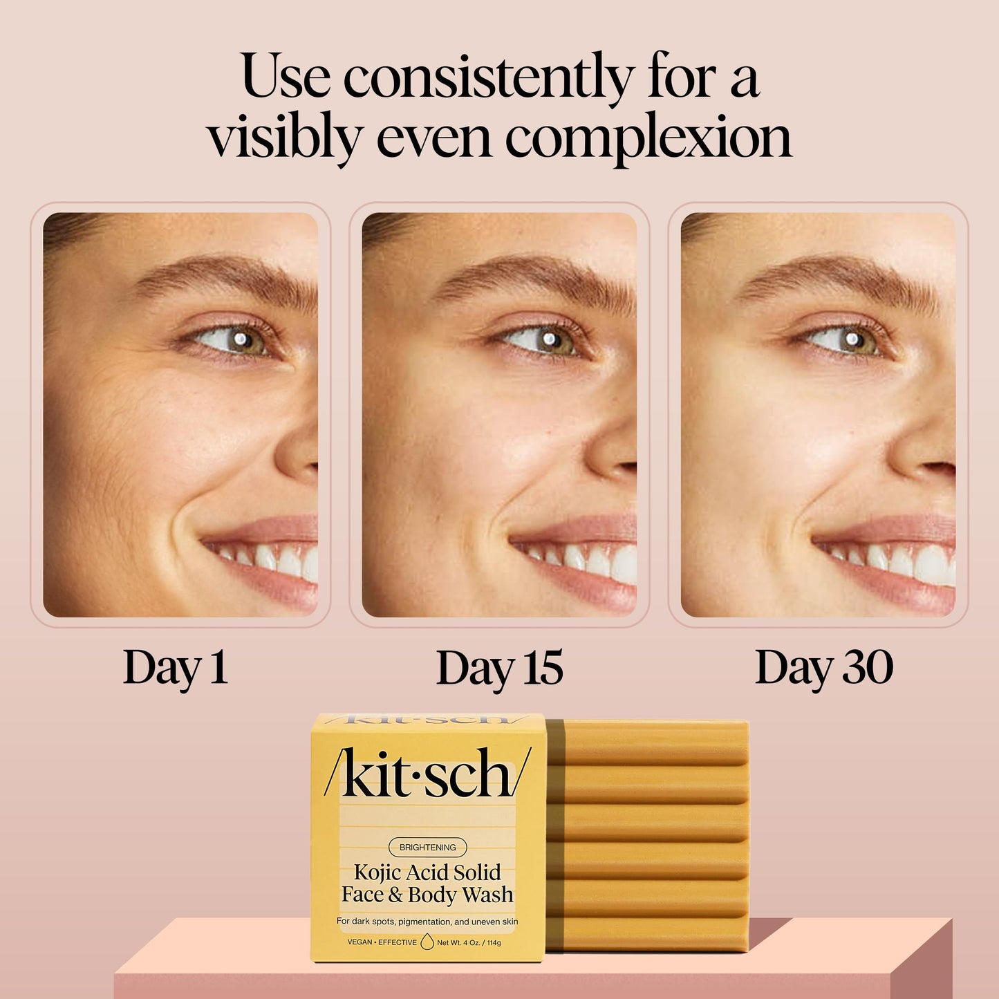 Kitsch Kojic Acid Soap - Brightening & Hydrating Kojic with Turmeric Soap Bar - Reduces Dark Spots, Evens Skin Tone, With Hyaluronic Acid & Shea Butter, Paraben & Sulfate-Free - 4oz, Made in USA
