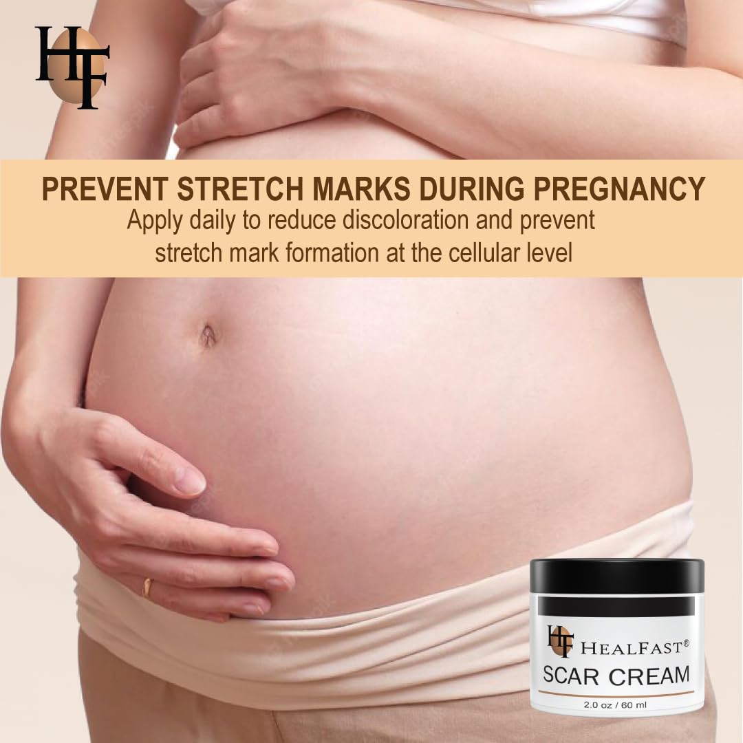 HealFast The Original Scar Cream for Stretch Marks – Soothes, Nourishes and Refreshes Skin – Using Ovasome Technology with Allantoin & Alpha LIpoic Acid – 2 Oz/ 60 ml