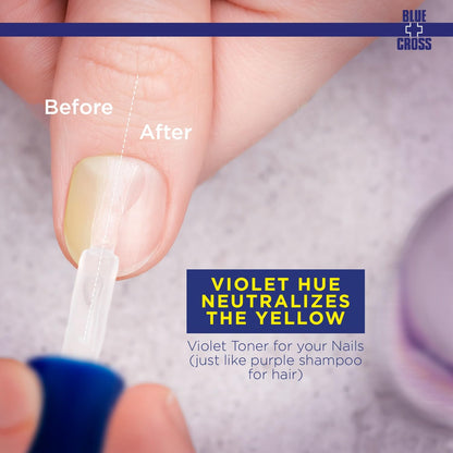 Blue Cross Yello Out, Yellow-Neutralizing Basecoat, Purple Toner for Yellow Nails + Fingernail Polish Color Enhancer, Professional Nail Care, Made in USA, 15mL/0.5fl oz