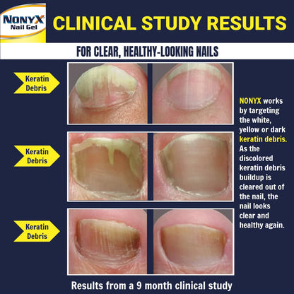 NONYX Nail Clarifying Gel | Clinically Proven for Discolored and Damaged Toenails | Restores the Appearance of Thick, Brittle, Yellow or Lifted Nails | Effective Nail Care Treatment | Made in the USA