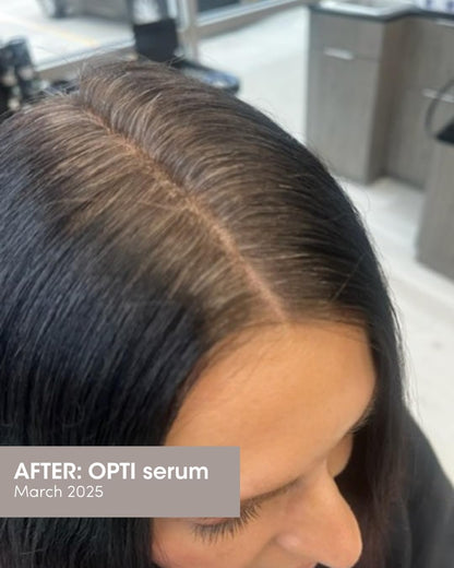 SEVEN SATARA OPTI Shampoo for Women & Men, Hair Growth & Thinning Solutions with Procapil + Capixyl, Promotes Fuller, Healthier Locks, Plant-Based Hair Shampoo for Vitality & Restoration, 32 fl oz