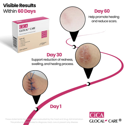 Cica GlocalCare – Clinically Proven Wound Healing Supplement - Aids in Scar & Recovery Support - Helps with Skin & Tissue Repair for Surgery, Wounds, Scar Treatment & Bruising (30 Capsules)