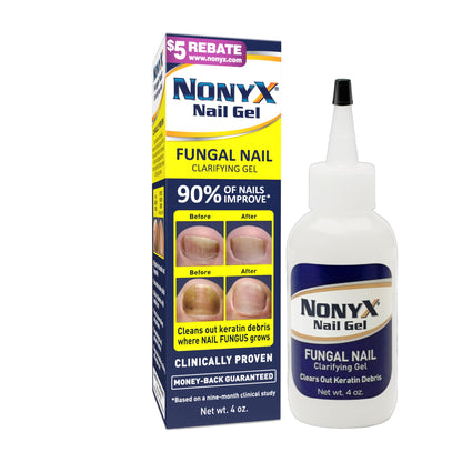 NONYX Nail Clarifying Gel | Clinically Proven for Discolored and Damaged Toenails | Restores the Appearance of Thick, Brittle, Yellow or Lifted Nails | Effective Nail Care Treatment | Made in the USA