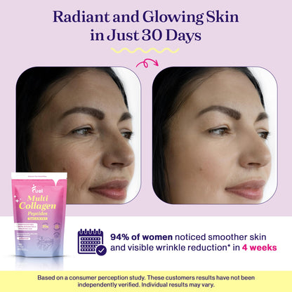 Fuel Multi Collagen Peptides Powder – 20g Hydrolyzed Collagen I, II, III, V & X for Hair, Skin, Nails & Joint Support – Better Absorption – Keto & Gluten Free, Unflavored 9.31oz