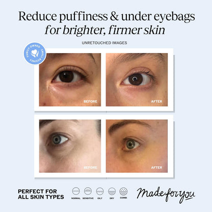 LilyAna Naturals Eye Cream for Dark Circles and Puffiness, Under Eye Cream for Wrinkles and Bags, Anti Aging - helps Improve Dryness; for Sensitive Skin - 1.7 oz - Made in USA