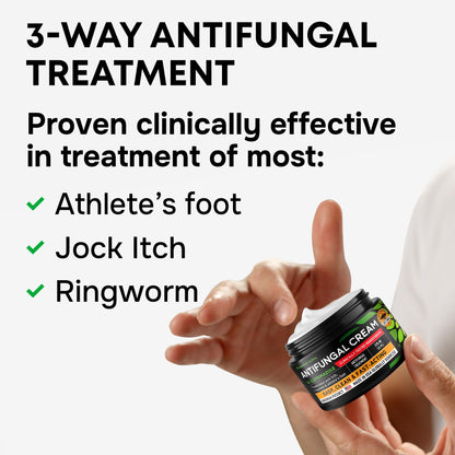 Clotrimazole Antifungal Cream - Treats Most Athlete’s Foot, Jock Itch, Ringworm - Clotrimazole 1% Anti Fungal Cream for Skin, Athletes Foot Treatment, Ring Worm Medication for Humans - 2oz Made in USA