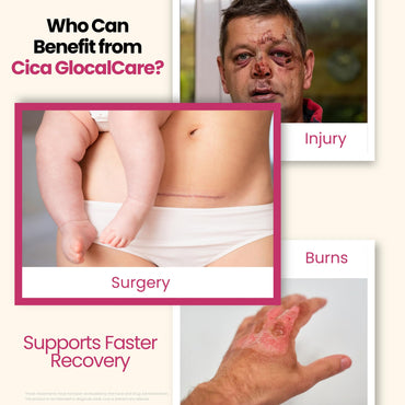 Cica GlocalCare – Clinically Proven Wound Healing Supplement - Aids in Scar & Recovery Support - Helps with Skin & Tissue Repair for Surgery, Wounds, Scar Treatment & Bruising (30 Capsules)
