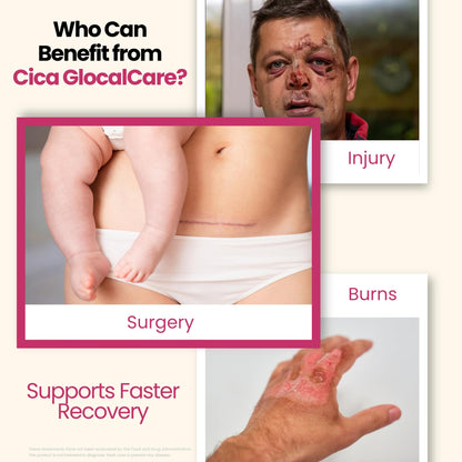 Cica GlocalCare – Clinically Proven Wound Healing Supplement - Aids in Scar & Recovery Support - Helps with Skin & Tissue Repair for Surgery, Wounds, Scar Treatment & Bruising (30 Capsules)