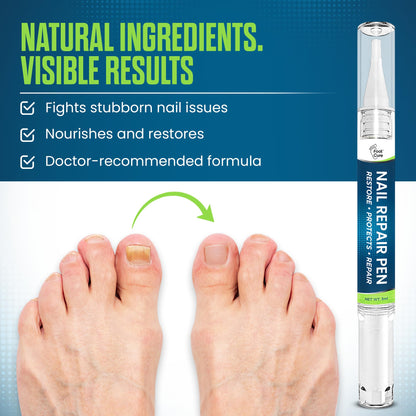 Footcure Toenail Fungus Treatment Extra Strength – 25% Undecylenic Acid Antifungal Pen, Repair & Restore Toenails & Fingernails, Natural Tea Tree & Oregano Oil, Made in USA (2-Pack)