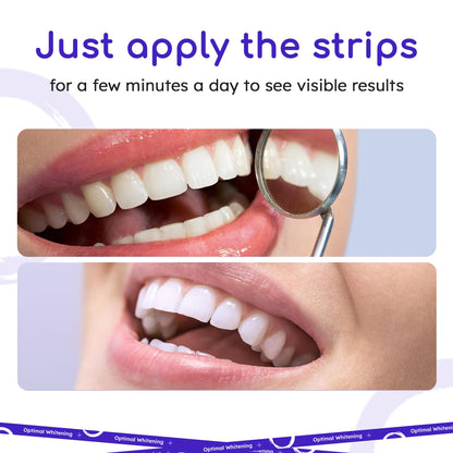 Teeth Whitening Strips for Sensitive Teeth | 14-Day Full Treatment Whitening Kit | Fast-Acting Whitening | Removes Tough Stains | Easy to Use, Comfortable Fit | Self Care & Personal Care Products