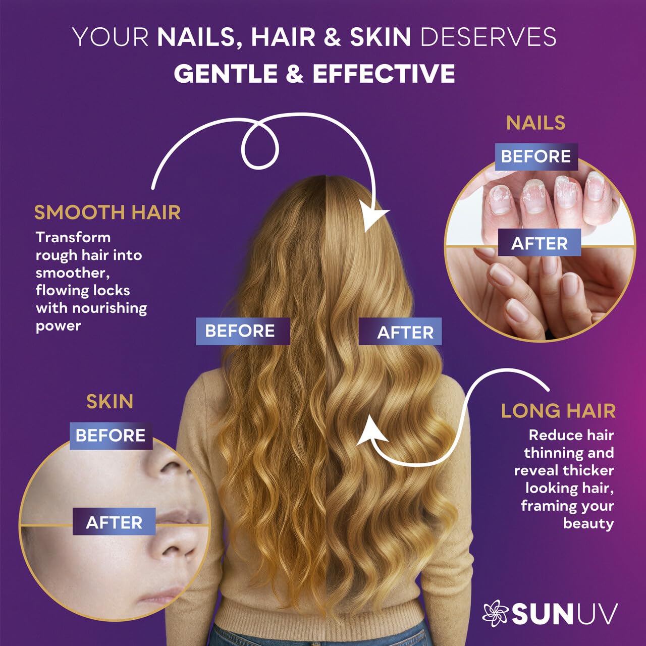 SUNUV Biotin 10,000mcg | Collagen | Keratin - 80,000mcg Hair Growth Vitamins for Women & Men,Skin & Nails Support - Hyaluronic Acid & Vitamins B1,B2,B3,B5,B6,B9,B12 -Made in USA-90 Capsules