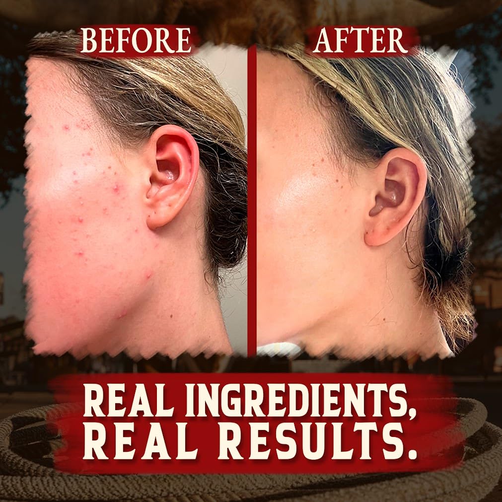 Organic Beef Tallow for Skin - 4 OZ (Pack of 3) — US-Made Grass Fed Beef Tallow for Face + Body — Whipped Tallow and Honey Balm Moisturizer for Dry and Sensitive Skin, Eczema, Rosacea (No Additives)