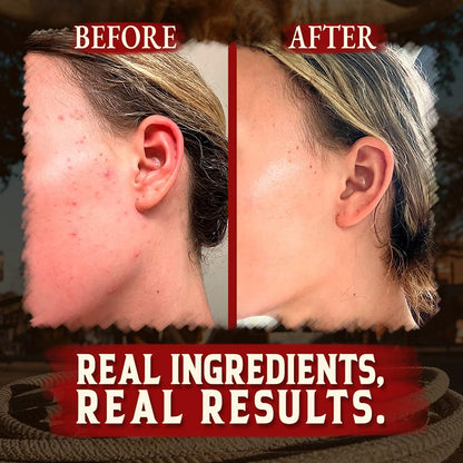 Organic Beef Tallow for Skin - 4 OZ (Pack of 3) — US-Made Grass Fed Beef Tallow for Face + Body — Whipped Tallow and Honey Balm Moisturizer for Dry and Sensitive Skin, Eczema, Rosacea (No Additives)
