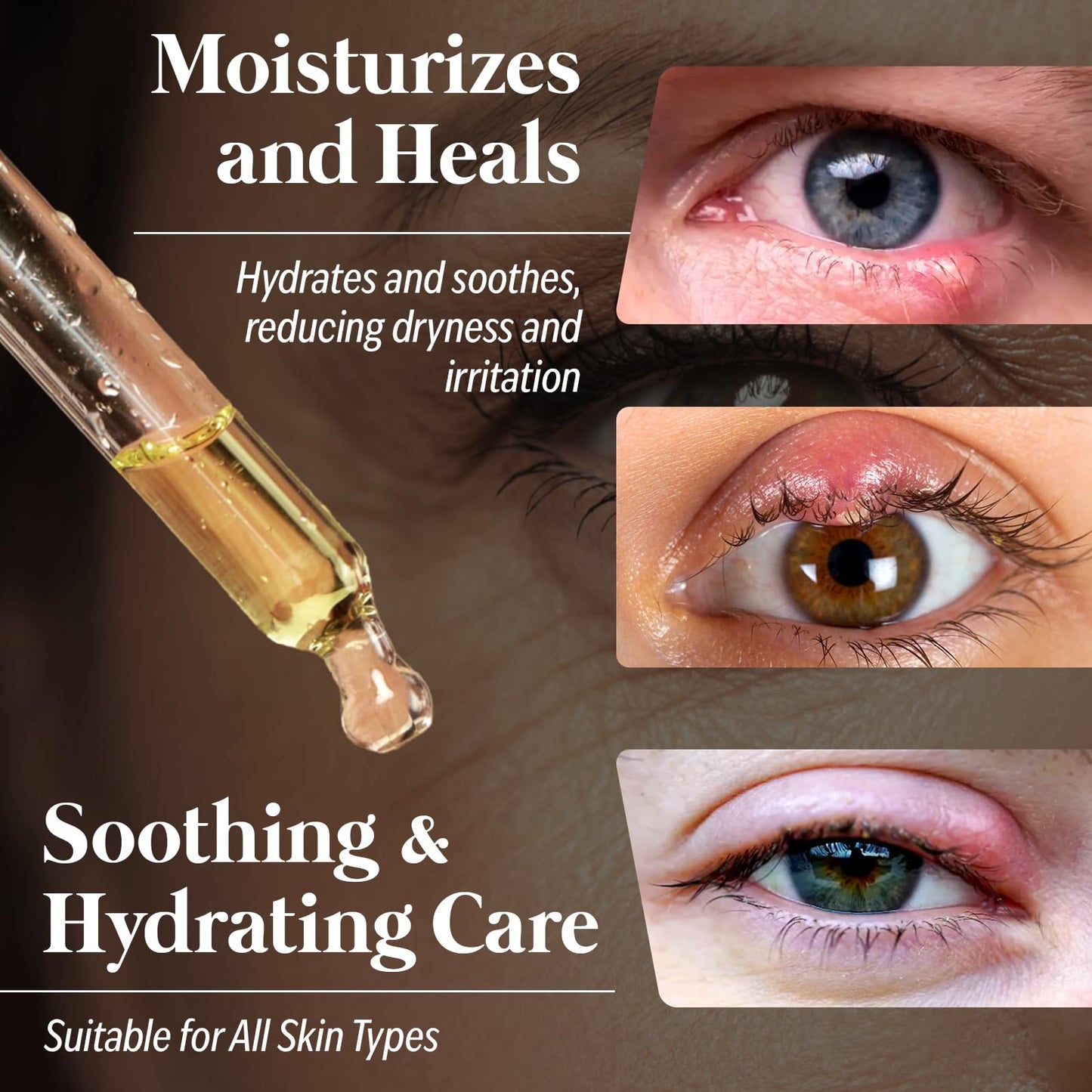 Eye Serum for Styes, Chalazions, and Blepharitis, 15 mL – Plant-Based Formula – Made in USA