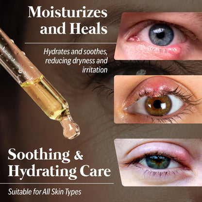 Eye Serum for Styes, Chalazions, and Blepharitis, 15 mL – Plant-Based Formula – Made in USA