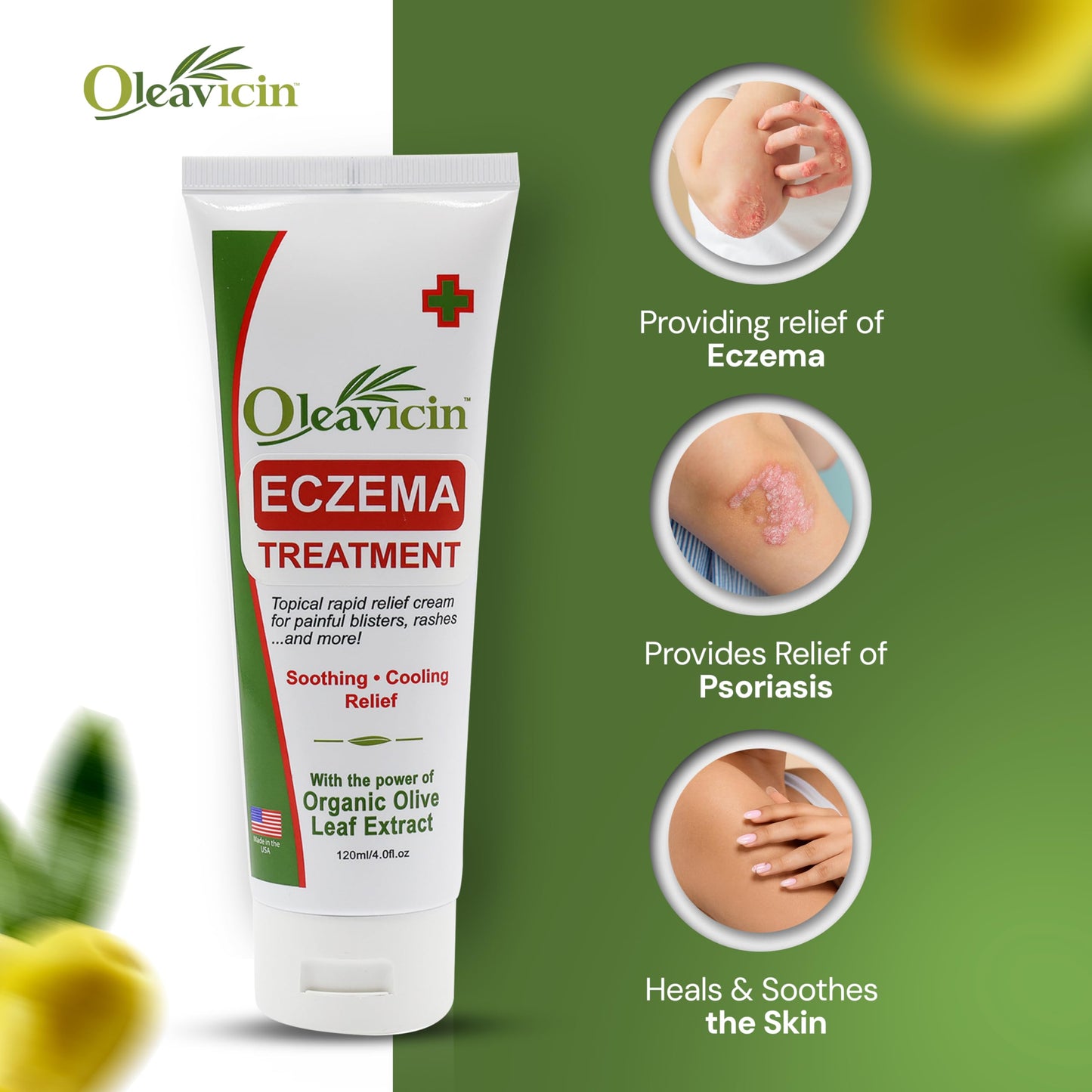 Oleavicin Eczema Treatment Cream - Steroid-Free, Organic Olive Leaf Extract, Soothing & Hydrating for All Skin Types, Kids & Adults