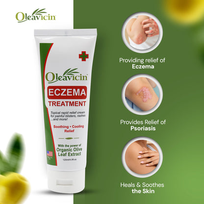 Oleavicin Eczema Treatment Cream - Steroid-Free, Organic Olive Leaf Extract, Soothing & Hydrating for All Skin Types, Kids & Adults