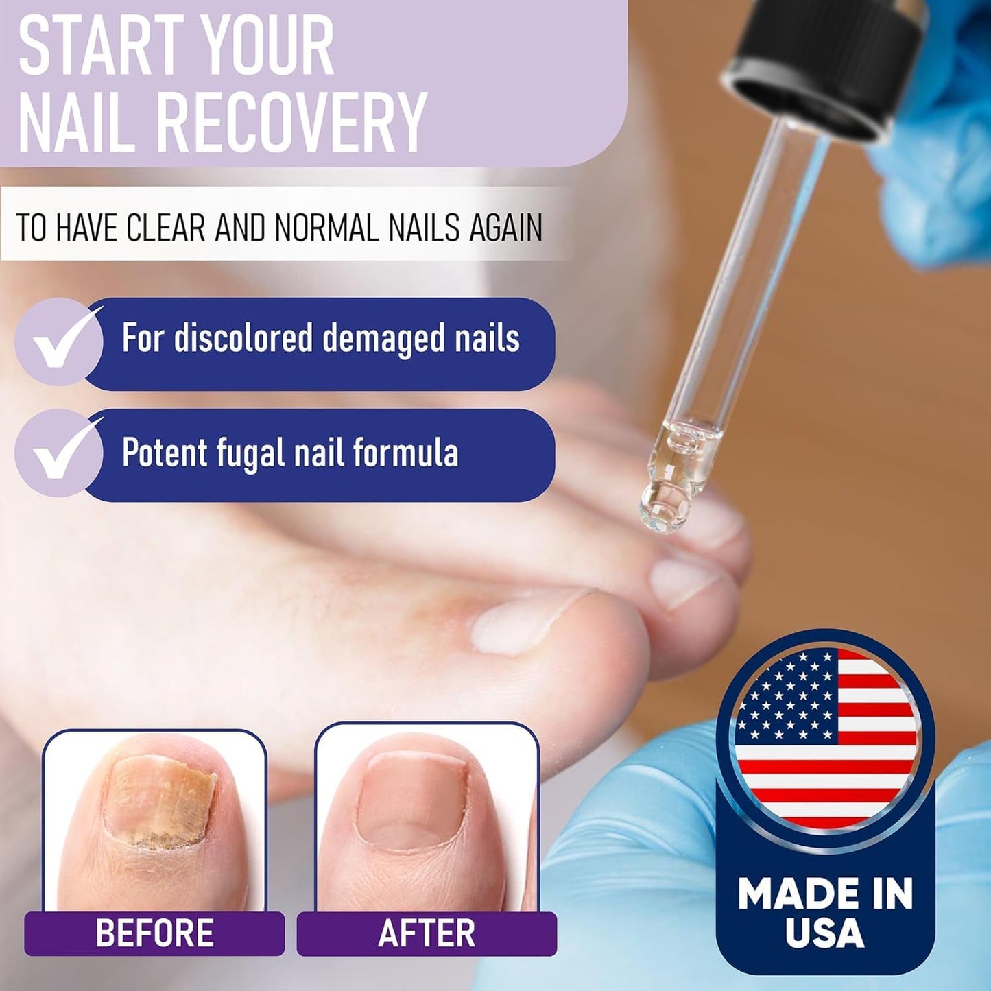 Zanaquick Extra Strength Toenail & Fingernail Repair Drops - Nail Care Renewal for Thick, Damaged & Discolored Nails - 1 Pack