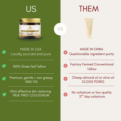 100% Grass Fed Tallow Balm with First Colostrum & Emu Oil - Handmade in USA Whipped Beef Tallow for Face and Body, Sensitive Skin Tallow Moisturizer made with True First Colostrum, (Lavender Mist)