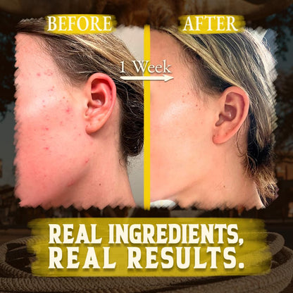 Organic Beef Tallow for Skin - 4 OZ (Citrus) — US-Made Grass Fed Beef Tallow for Face + Body — Whipped Tallow and Honey Balm Moisturizer for Dry and Sensitive Skin, Eczema, Rosacea (No Additives)