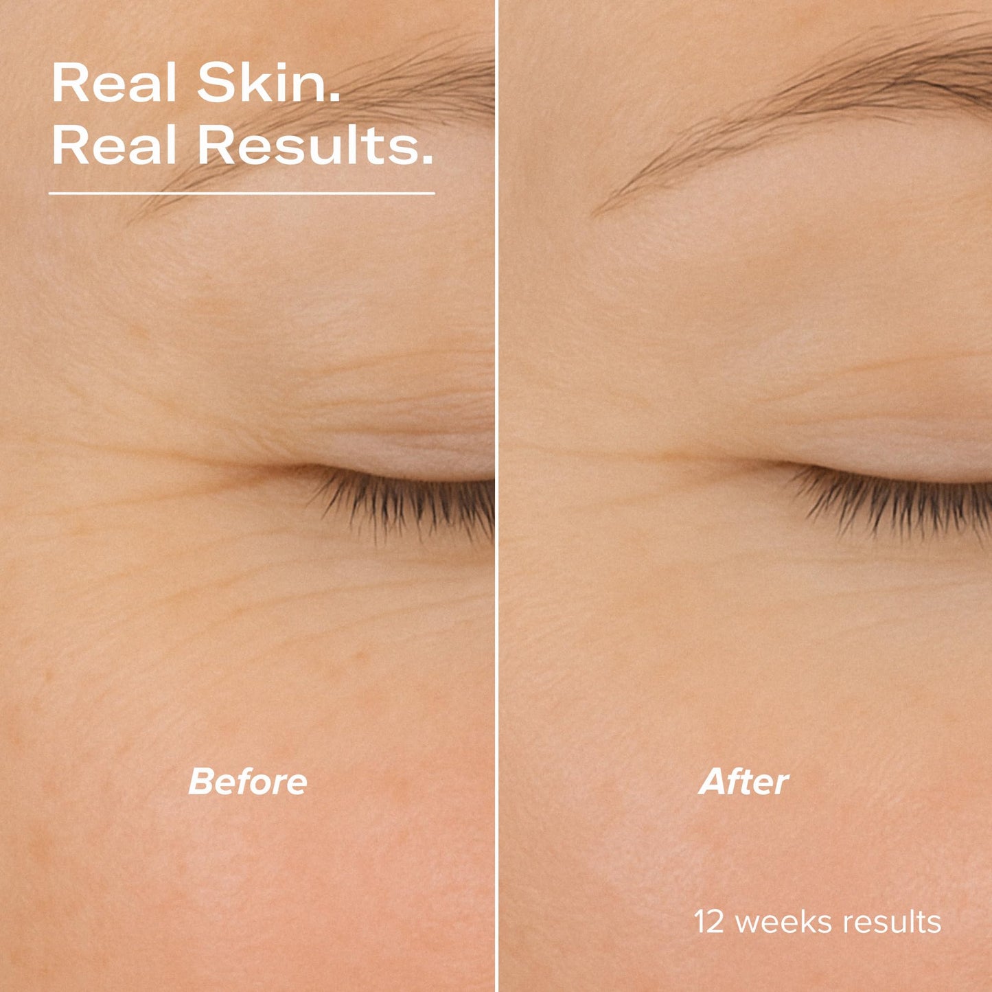 serum junkie SMOOTH Retinol and Peptide Serum with Encapsulated Retinol, Bakuchiol, Matrixyl 3000, Melatonin, Vitamin E, Anti-Aging, Targets Fine Lines, Uneven Texture, Dullness, 1 fl oz