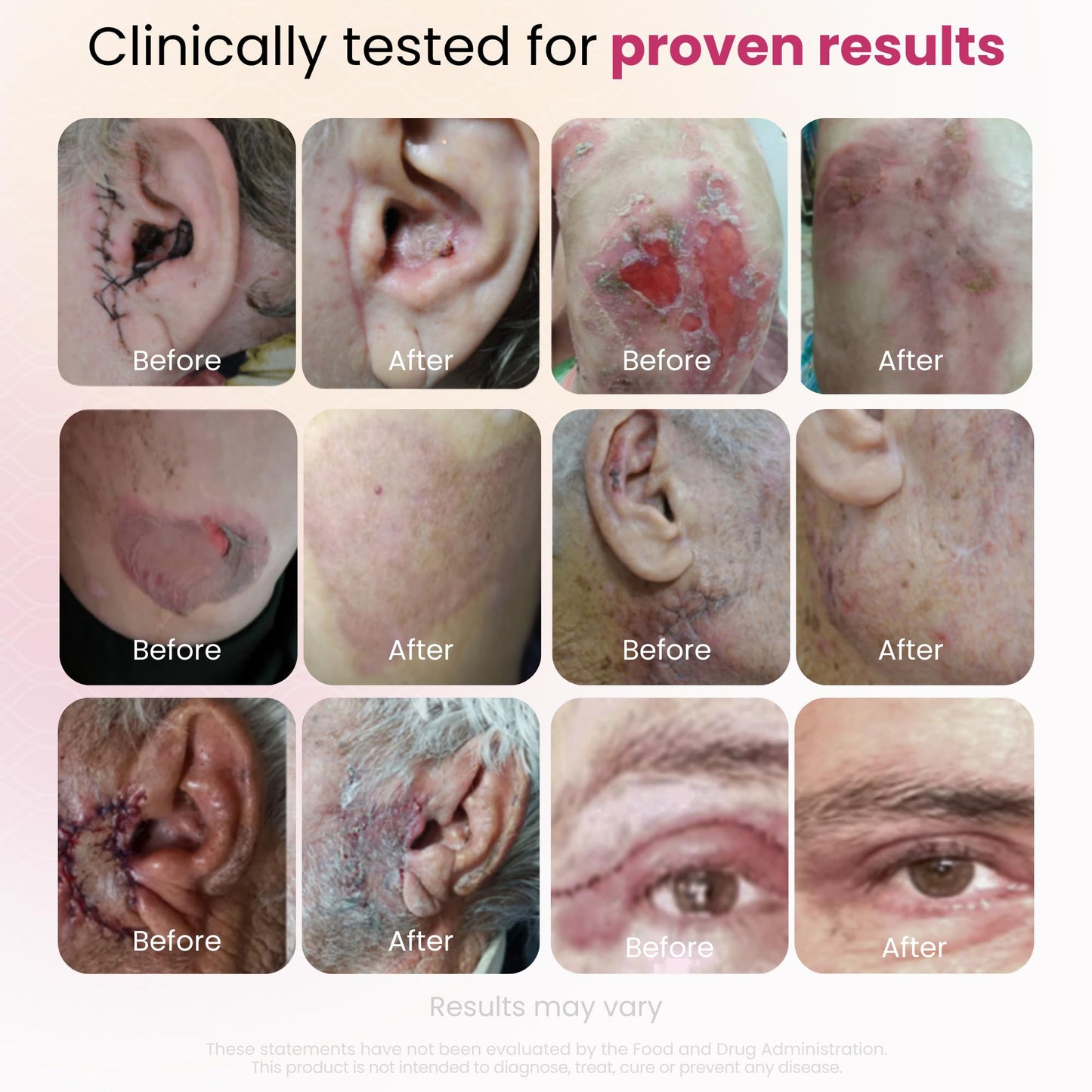 Cica GlocalCare – Clinically Proven Wound Healing Supplement - Aids in Scar & Recovery Support - Helps with Skin & Tissue Repair for Surgery, Wounds, Scar Treatment & Bruising (30 Capsules)