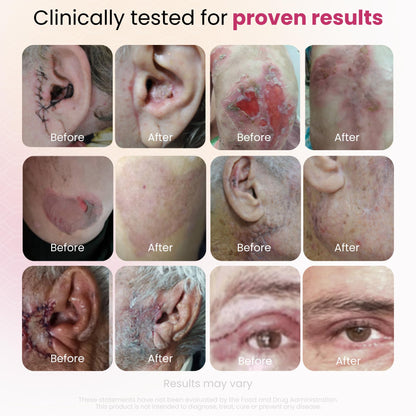 Cica GlocalCare – Clinically Proven Wound Healing Supplement - Aids in Scar & Recovery Support - Helps with Skin & Tissue Repair for Surgery, Wounds, Scar Treatment & Bruising (30 Capsules)