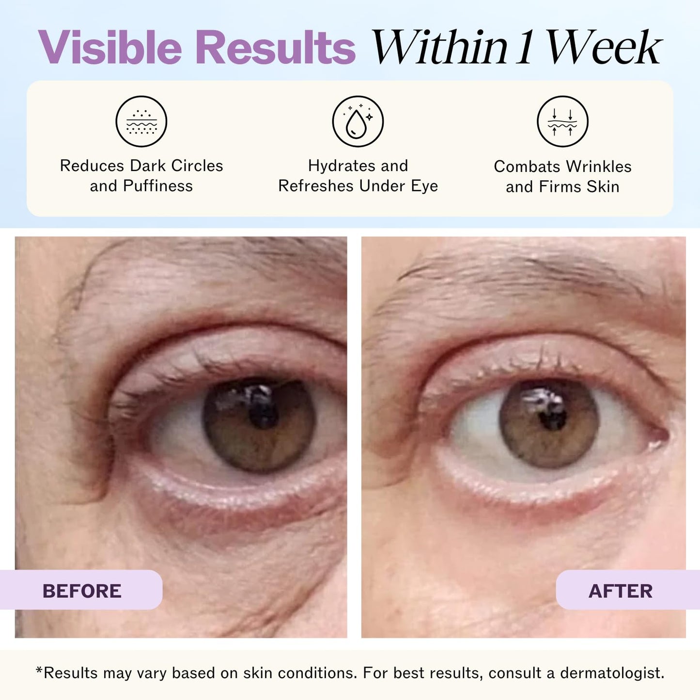 LilyAna Naturals Eye Cream for Dark Circles and Puffiness, Under Eye Cream for Wrinkles and Bags, Anti Aging - helps Improve Dryness; for Sensitive Skin - 1.7 oz - Made in USA