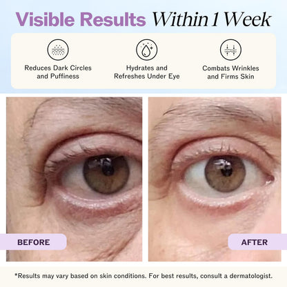 LilyAna Naturals Eye Cream for Dark Circles and Puffiness, Under Eye Cream for Wrinkles and Bags, Anti Aging - helps Improve Dryness; for Sensitive Skin - 1.7 oz - Made in USA