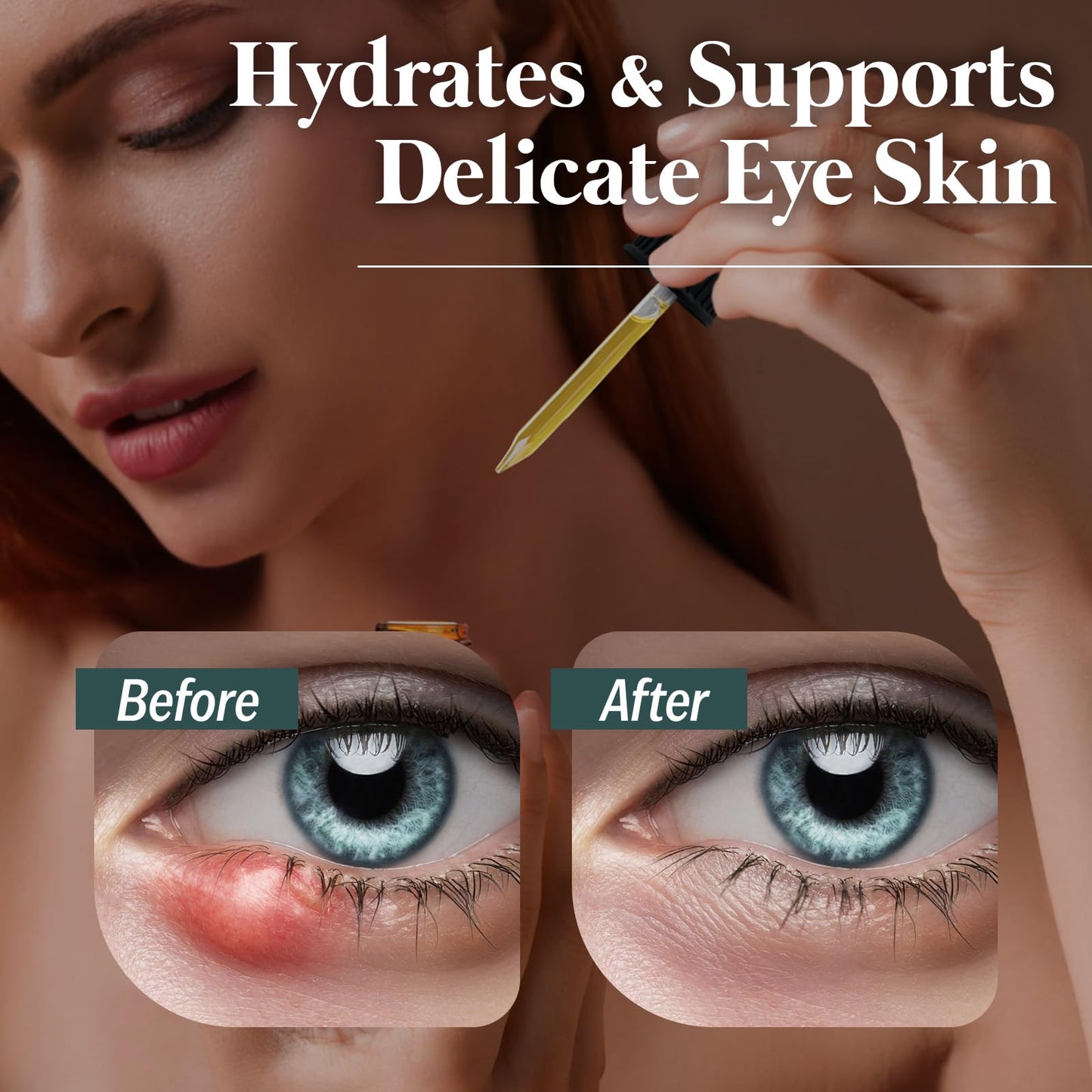 Eye Serum for Styes, Chalazions, and Blepharitis, 15 mL – Plant-Based Formula – Made in USA
