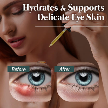 Eye Serum for Styes, Chalazions, and Blepharitis, 15 mL – Plant-Based Formula – Made in USA