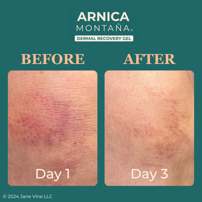 JANE VINE Arnica Gel For Face, Arnica Cream and Bruise Cream to Soothe with Aloe and Calendula for Face and Body, Menthol Free, Alcohol Free, 7oz Pump