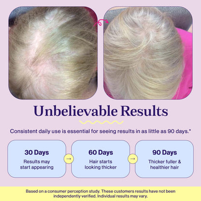 Fuel Multi Collagen Peptides Powder – 20g Hydrolyzed Collagen I, II, III, V & X for Hair, Skin, Nails & Joint Support – Better Absorption – Keto & Gluten Free, French Vanila 8.67oz