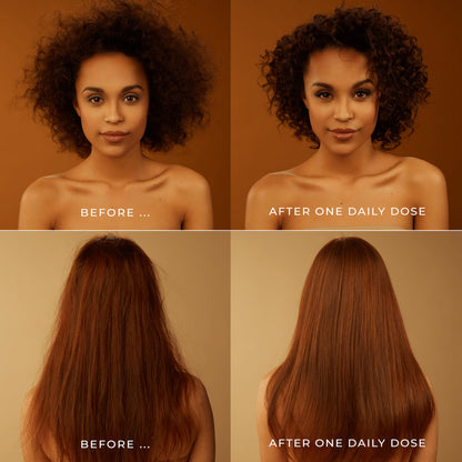 DAILY DOSE Effortless Detangler Spray & Leave In Conditioner for Dry, Damaged, & Frizzy Hair. Instantly Softens, Smooths & Adds Shine. For Kids & Adults. Award-winning, Vegan, Sulfate-Free, Color Safe