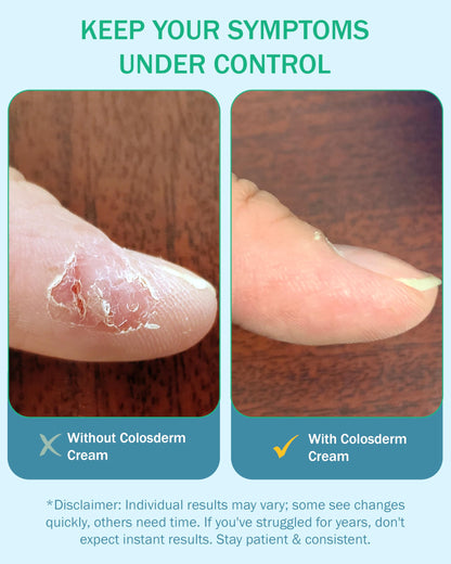 Eczema Cream for Kids & Adults, Daily Moisturizing Body Lotion for Sensitive Skin, Soothing Eczema Treatment Relief, Colloidal Oatmeal & Colostrum for Dry & Itchy Skin, Steroid- & Fragrance-Free, 4 oz