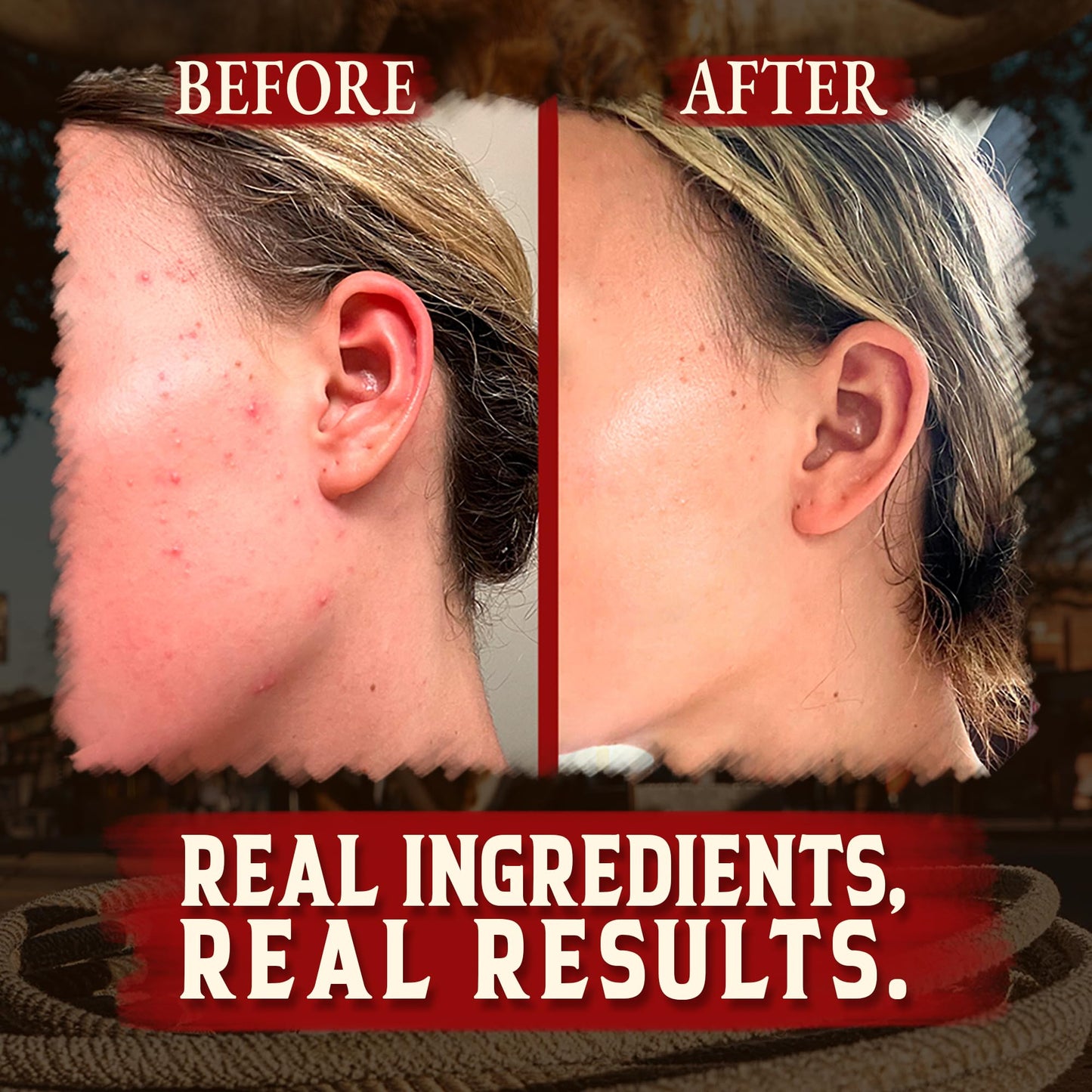 Organic Beef Tallow for Skin - 4 OZ (Vanilla) — US-Made Grass Fed Beef Tallow for Face + Body — Whipped Tallow and Honey Balm Moisturizer for Dry and Sensitive Skin, Eczema, Rosacea (No Additives)