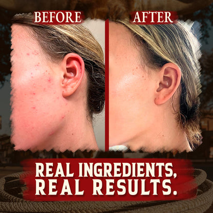 Organic Beef Tallow for Skin - 4 OZ (Vanilla) — US-Made Grass Fed Beef Tallow for Face + Body — Whipped Tallow and Honey Balm Moisturizer for Dry and Sensitive Skin, Eczema, Rosacea (No Additives)