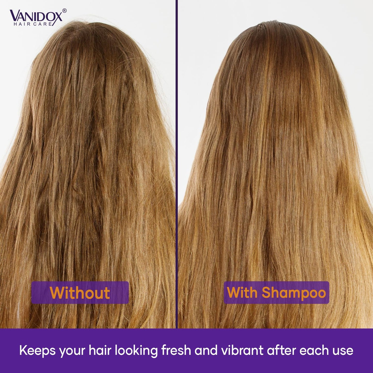 VANIDOX Sulfate Free Brass Toning Purple Shampoo and Conditioner Set for Blondes, Brown Highlighted, or Bleached Hair, Infused with Purple Rice Extract (16 fl oz each)