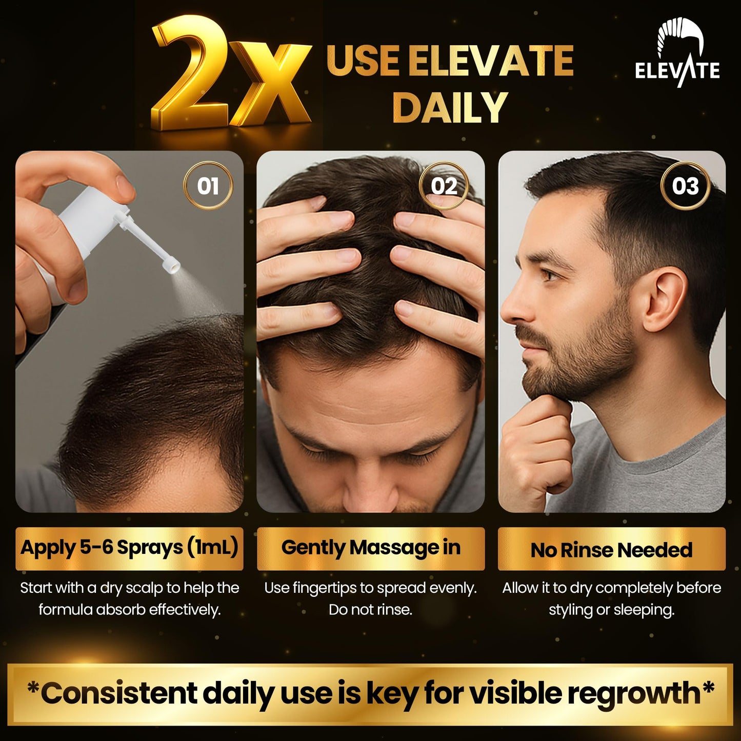 Elevate Hair Regrowth Treatment 5% Minoxidil Spray for Men - Clinically Proven Formula Fast Absorbing for Hair Loss and Growth Unscented Topical Hair Spray for Thinning & Balding Hair - Made in USA
