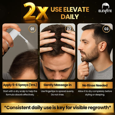 Elevate Hair Regrowth Treatment 5% Minoxidil Spray for Men - Clinically Proven Formula Fast Absorbing for Hair Loss and Growth Unscented Topical Hair Spray for Thinning & Balding Hair - Made in USA