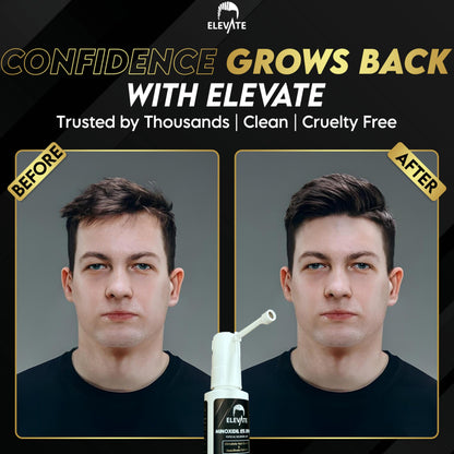 Elevate Hair Regrowth Treatment 5% Minoxidil Spray for Men - Clinically Proven Formula Fast Absorbing for Hair Loss and Growth Unscented Topical Hair Spray for Thinning & Balding Hair - Made in USA