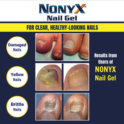 NONYX Nail Clarifying Gel | Clinically Proven for Discolored and Damaged Toenails | Restores the Appearance of Thick, Brittle, Yellow or Lifted Nails | Effective Nail Care Treatment | Made in the USA